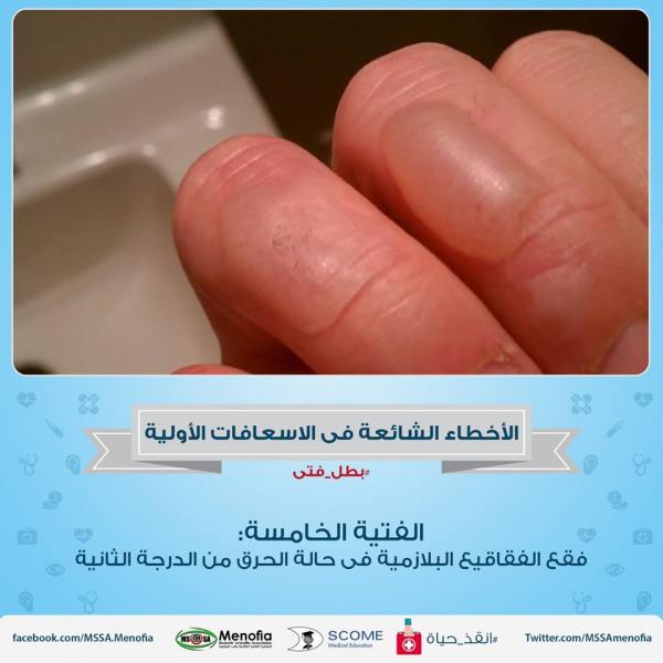 اضغط على الصورة لعرض أكبر

الاســـم:	5.jpg
المشاهدات:	8300
الحجـــم:	36.7 كيلوبايت
الرقم:	2609